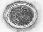 Světelná mikroskopie polarizační mikroskopie Světelná mikroskopie interferenční mikroskopie Světelná mikroskopie histologické barvení hematoxylin BAZICKÁ BARVIVA nukleové kyseliny, modré zbarvení