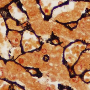 Barvení v histologii Hematoxylin a eosin (HE) Trichrom