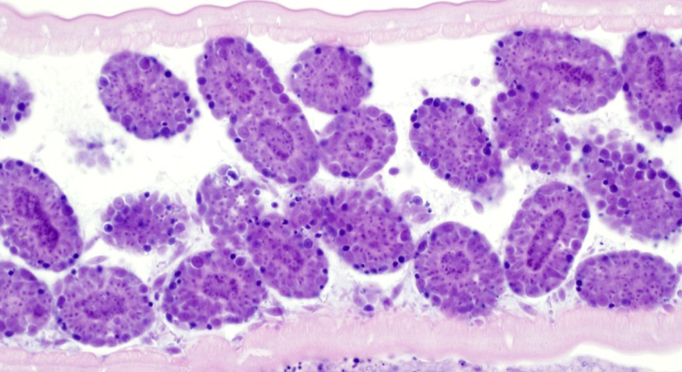 Diagnostické postupy v histopatologii Založeny na mikroskopickém vyšetření Histopatologické diagnózy versus etiologické diagnózy Čím je