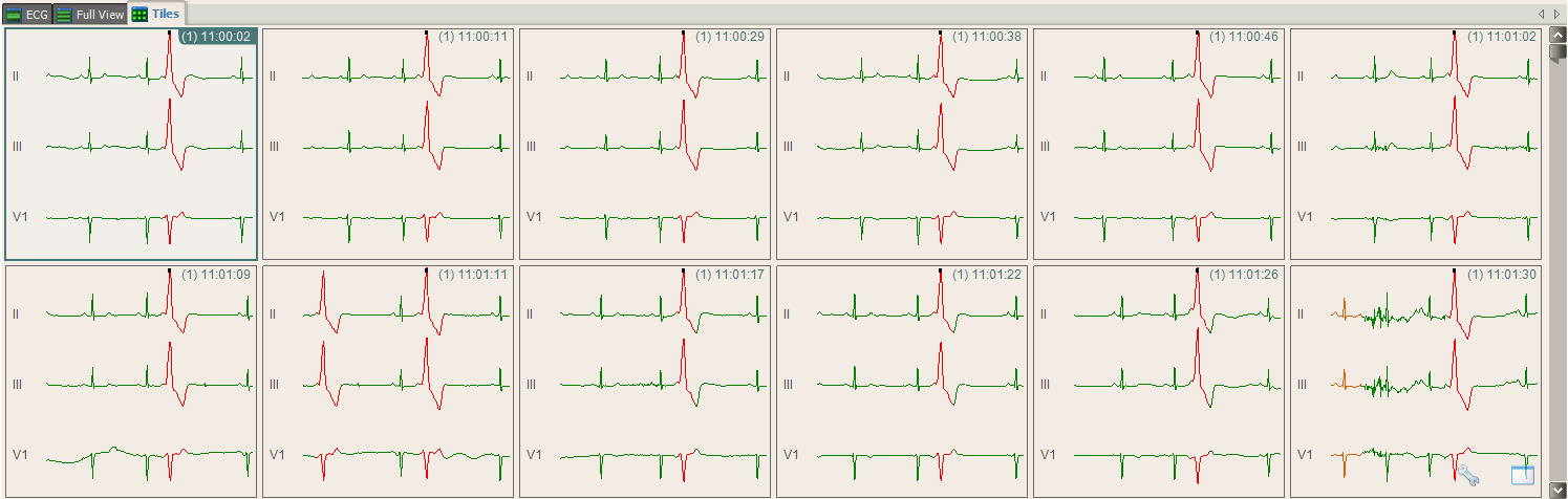 .6 PRÁCE SE SIGNÁLEM.6. Základní pohledy na signál EKG strip () je dostupný na každé obrazovce programu, podává základní pohled na EKG signál.