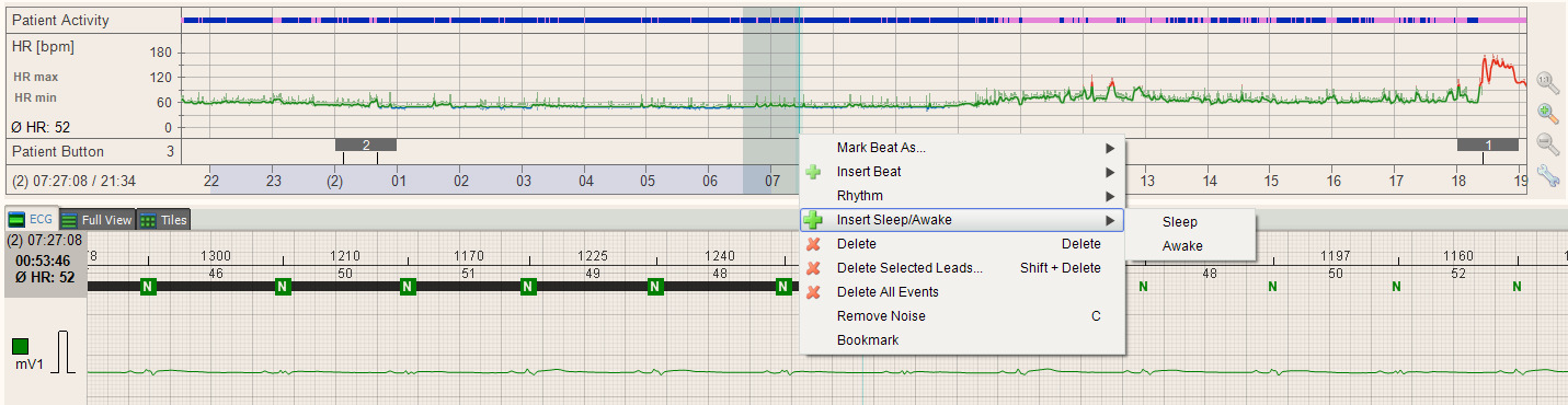 .6.8 Perioda bdění/spánku 3 Software provádí statistické výpočty zvlášť pro období bdění a období spánku. Jako období spánku je automaticky označne čas od :00 do 07:00.