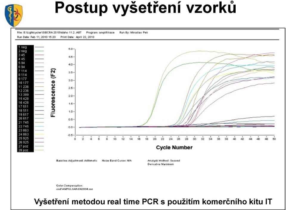 metodou real time PCR