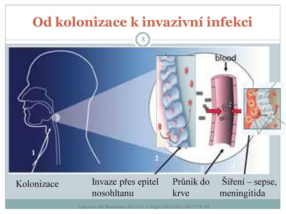 Průnik do krve Šíření sepse, meningitida