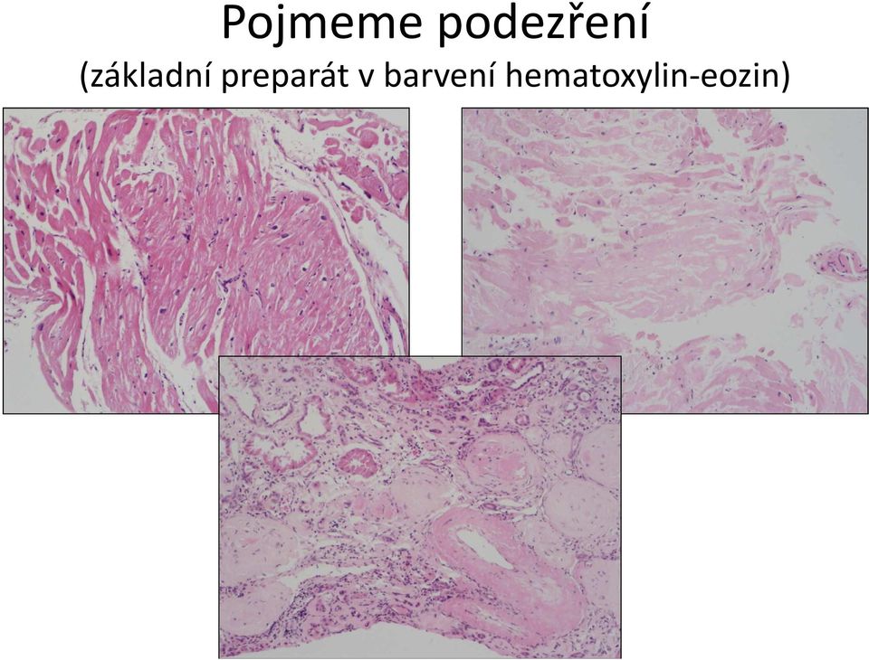 (základní