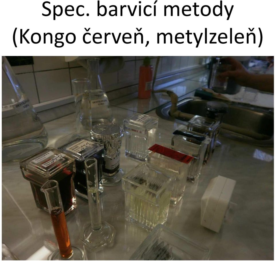 metody