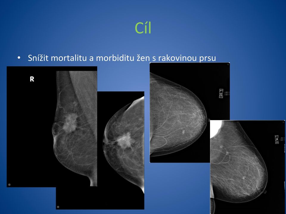 morbiditu žen