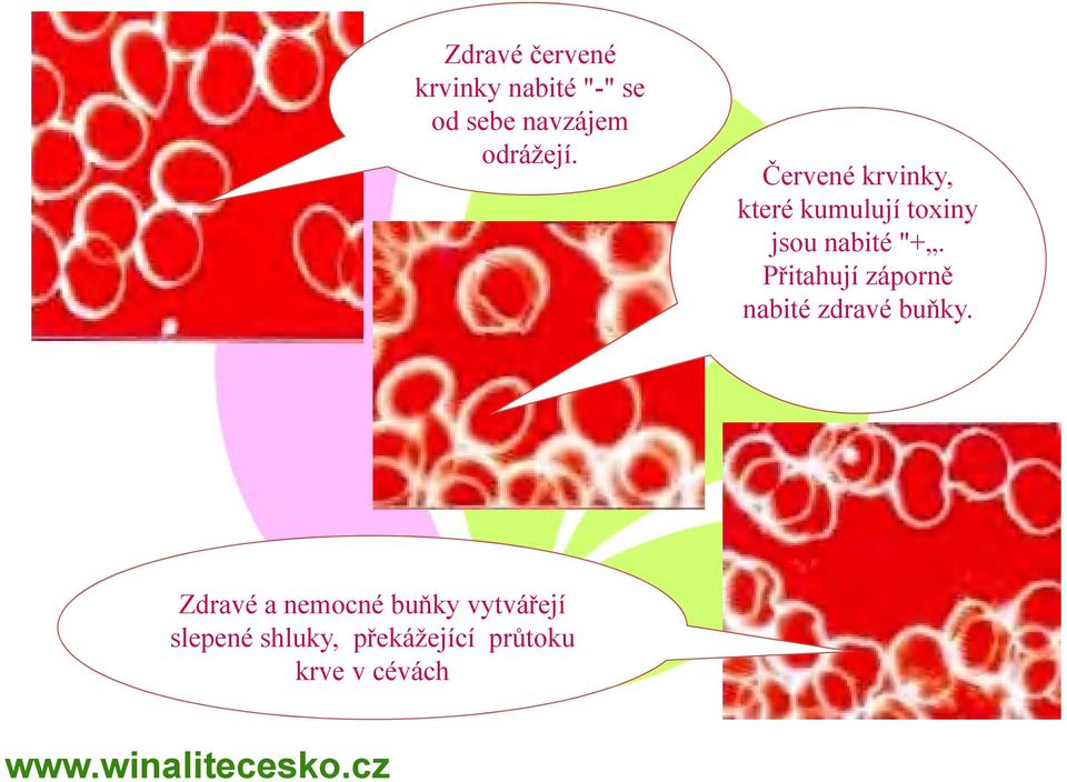 Červené krvinky, které kumulují toxiny jsou nabité "+.