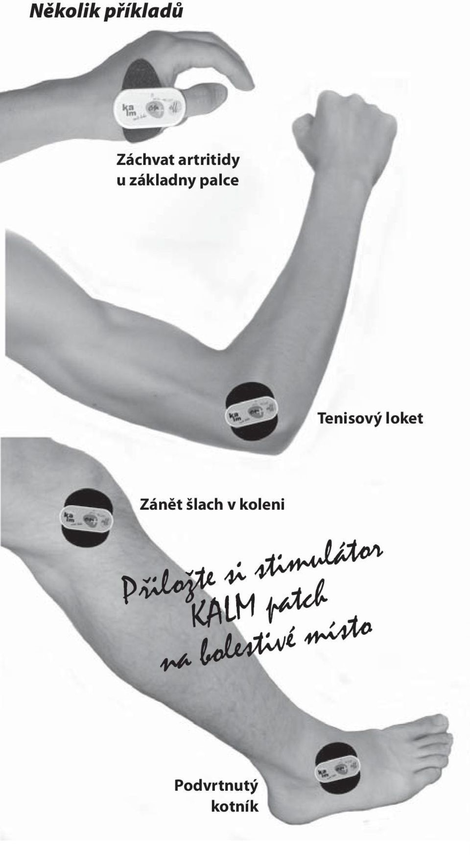 šlach v koleni Přiložte si stimulátor