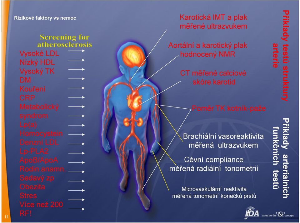 Karotická IMT a plak měřené ultrazvukem Aortální a karotický plak hodnocený NMR CT měřené calciové skóre karotid Poměr TK kotník-paže