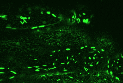 Endoplasmatické retikulum ER-tělíska (ER bodies) speciální struktury některých