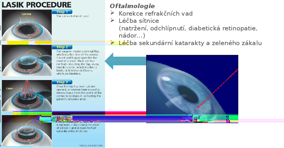 Aplikace v medicíně em [lasikfortworth.