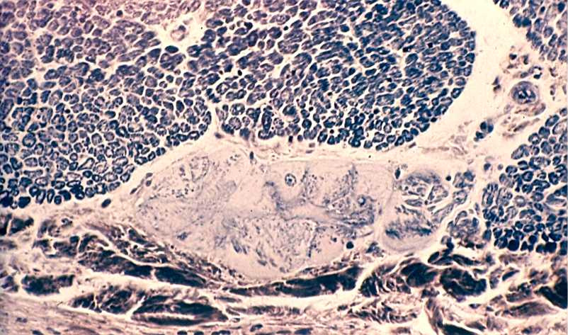 PŘEVODNÍ SYSTÉM SRDEČNÍ Purkyňova vlákna představují součást excitomotorického aparátu v komorovém úseku, kde navazují na uzlík siňokomorový a jako Hissův svazek běží v srdečním septu, aby se