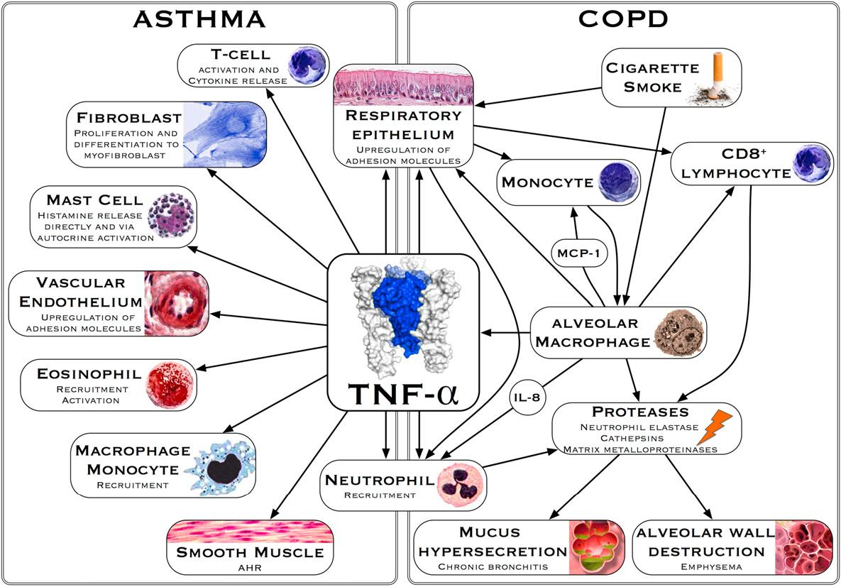 Obr. 3 Předpokládaná role TNFα v patogenezi astmatu a CHOPN (Matera et al., 2010). Existuje předpoklad, ţe TNF-α hraje centrální roli v patogenezi CHOPN.