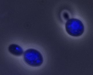 2. Pozorování sekundární fluorescence (metoda chemického barvení) Pozorování fluorescenčního světla generovaného fluorochromem (=próba, fluoreskující barvivo), kterým se obarví látka bez vlastní