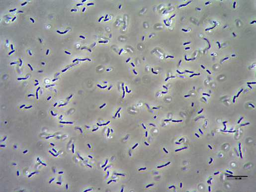 Obr. 6 Lactobacillus sake (www.alp.admin.ch) 3.4.2.3 Rod Staphylococcus, (čeleď Staphylococcaceae) Grampozitivní nepohyblivé, nesporulující, fakultativně anaerobní, koky o průměru 0,5 1,0 µm.