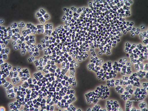 Obr. 7 Staphylococcus carnosus (www.alp.admin.ch) 3.4.2.