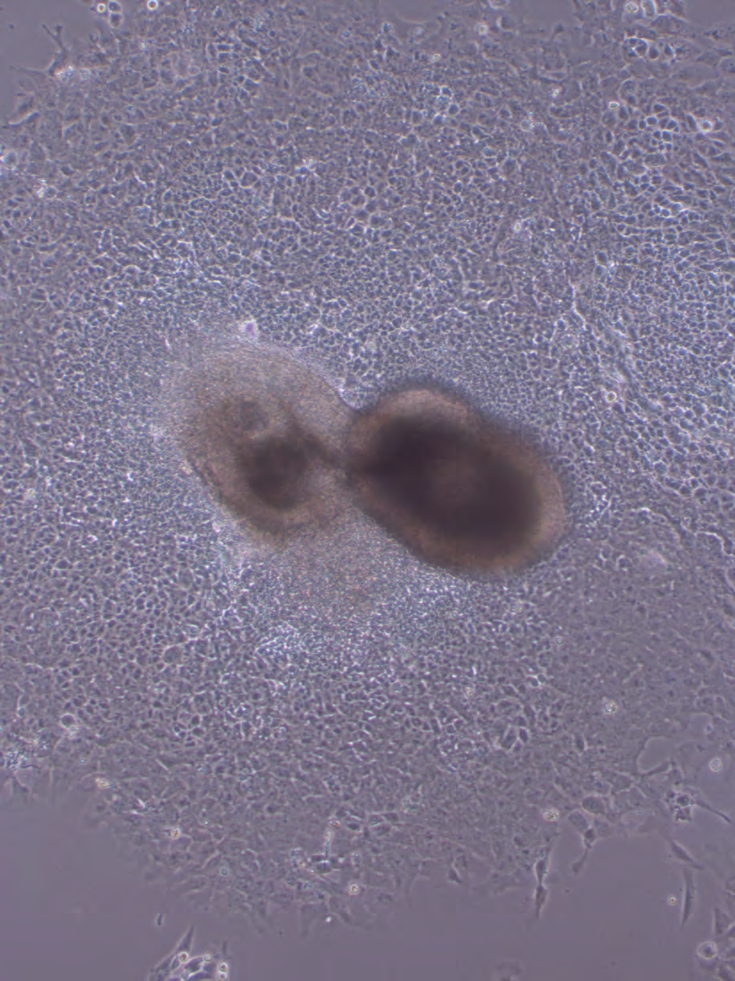 Embryoidní tělíska spontánní diferenciace buněk 7