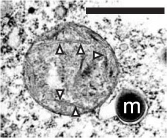 Evoluce eukaryotní buňky Hypotézy vzniku eukaryotní buňky - vodíková hypotéza archaea s předchůdcem mitochondrie v konzorciu došlo k pohlcení bakteriální buňky (a-proteobakterie produkující H 2 )