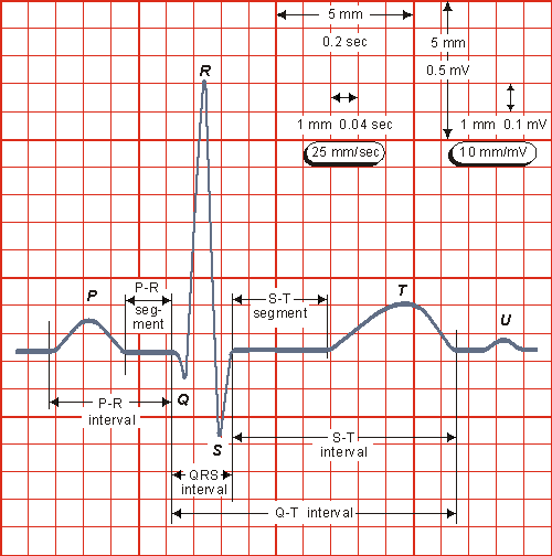 Elektrokardiografická křivka Malmivuo, J.