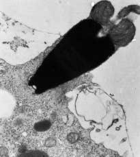 oplození vajíčka savci navíc vajíčko obaleno folikulárním buňkami (corona radiata) Campbell biology 10ed (Reece