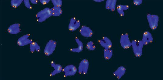 Reprodukce eukaryot struktura chromozomu p = petite (malý) q = v abecedě po p Telomera - ochrana konců chromosomů (proteiny) - brání rekombinaci s jinými chromosomy -