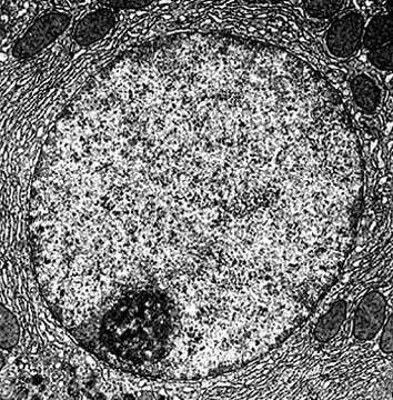 buněčný cyklus Úroveň despiralizace chromosomů buněk v interfázi se může lišit: Heterochromatin zachovány vyšší úrovně spiralizace (oblasti s geny,