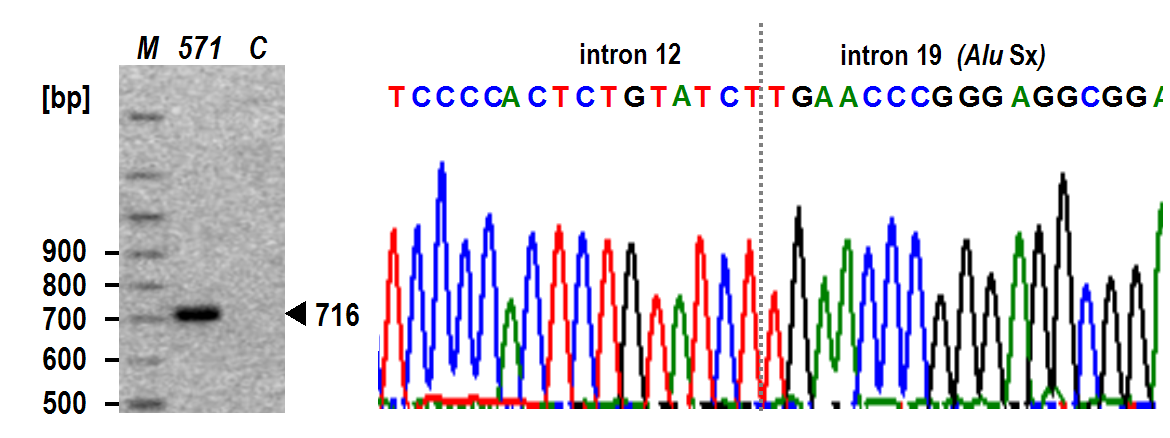 Obrázek 15: Charakterizace a určení bodů zlomu delece zahrnující exony 13-19 pomocí LR-PCR a sekvenování. Vlevo separace produktu amplifikace v agarosovém gelu.