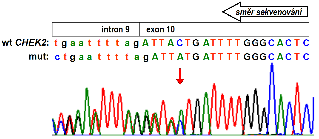 Mutace detekované v genu CHEK2 byly potvrzeny sekvenováním příslušného úseku genomové DNA (Obr.19 a 20). Obě mutace zasahují do kinázové domény proteinu (Obr. 6).