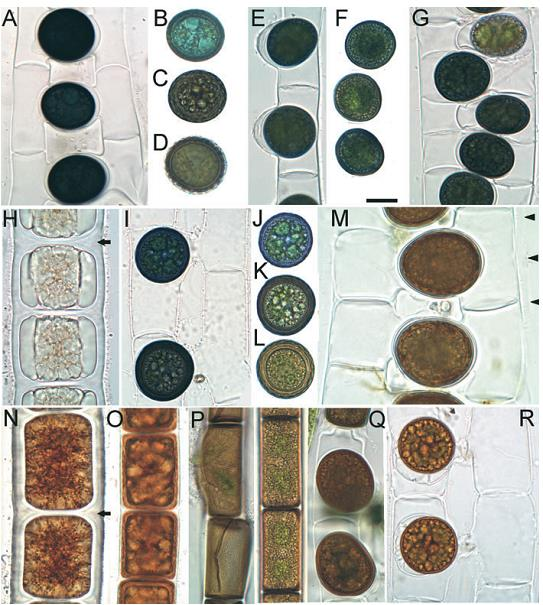 Příloha Obr. P1. Reprodukční struktury Zygnema z Kalifornie, A - Z. californicum (skalariformní konjugace), B- D Z. californicum zygospory, E a F - Z. aplanosporum (aplanospory), G - Z.