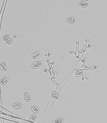 Řád: PERONOSPORALES zástupci jsou obligátní vysoce specializovaní parazité rostlin, mají cenocytické intercelulární mycelium (do buněk vysílají haustoria), vytvářejí na povrchu napadených orgánů