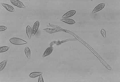 Peronospora destructor Plíseň cibulová příznaky napadení na