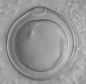 2 3 15µm 4 5 6 20µm 20µm Obr. 2-6. Amébovitá stádia heteroloboseí.