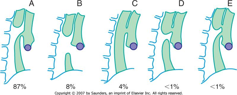 1) Atrézie jícnu Vrozené vývojové vady GIT trávicí trubice Nejčastější vrozenou vývojovou vadou (VVV) jícnu je atresie esofagu vyskytuje se s frekvencí cca 1:4000 živě narozených, u více než 90%