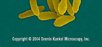 Salmonella typhi Tyčinky, tyčky Dělení jen v 1 rovině, vždy jen příčně. U bacilů poměr délka/šířka větší než 0,5. rovné (většina bakterií, E.