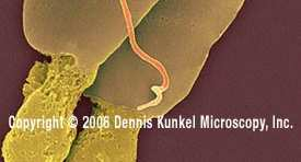 Další tvary tyčinek Mycelium tvořící aktinomycety, streptomycety Prostéky tvořící prostéka - buněčný výběžek s cytoplazmou,ohraničený cytoplazmatickou membránou a buněčnou stěnou