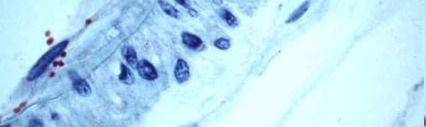 Velikost bakterií a) nejmenší Nejmenší rody: rickettsie a mykoplasmata, Nanobacterium Mycoplasma: Schopny samostatného růstu!