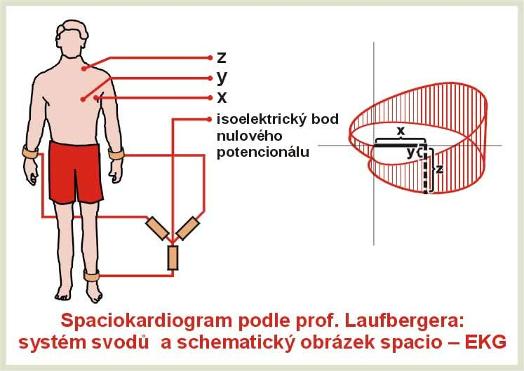 - 30 - Obrázek 20 Spaciokardiogram podle prof.