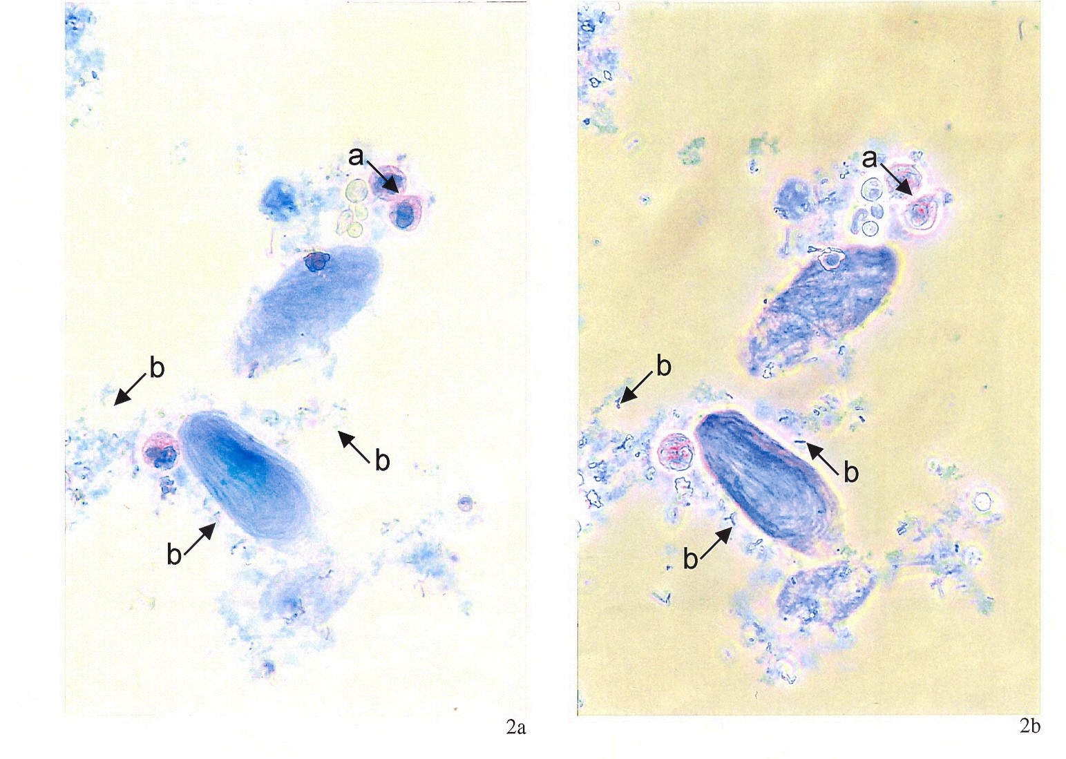 Granulocytv (šipka a) s vícelaločnatými (segmentovanými) jádry