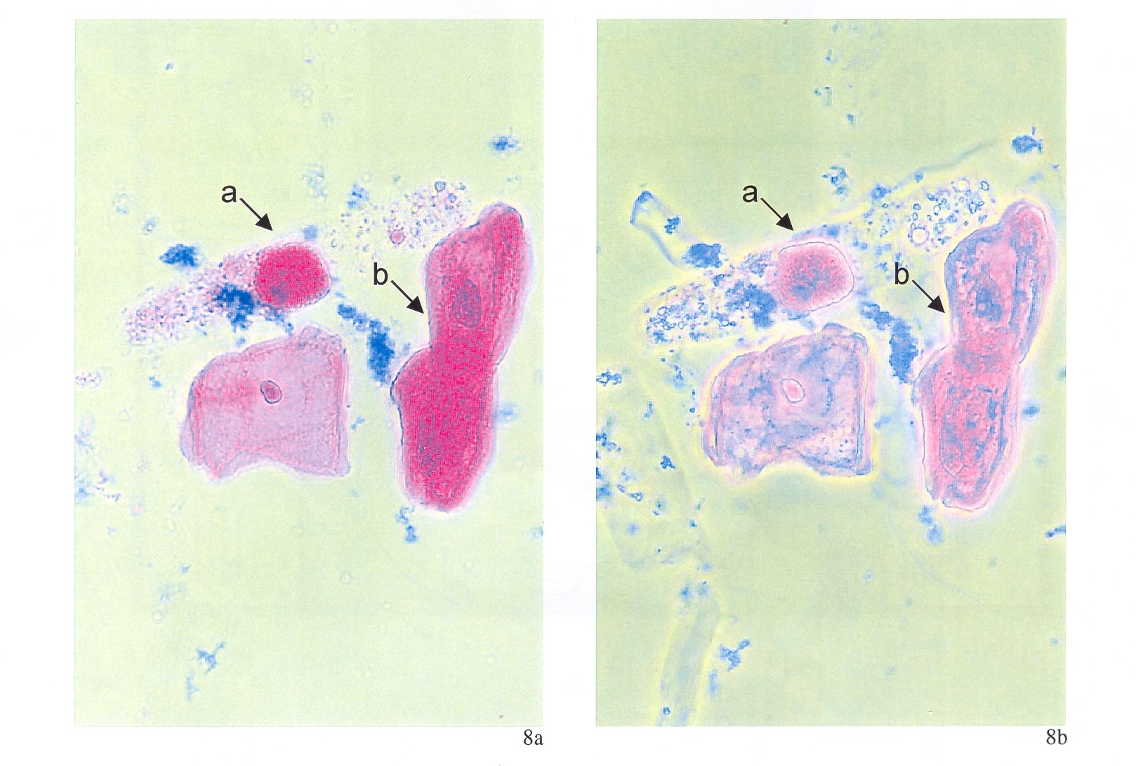 Rozdíl mezi buňkou tubulárního epitelu (šipka a) ( granul. cytoplazma uvnitř hyal.