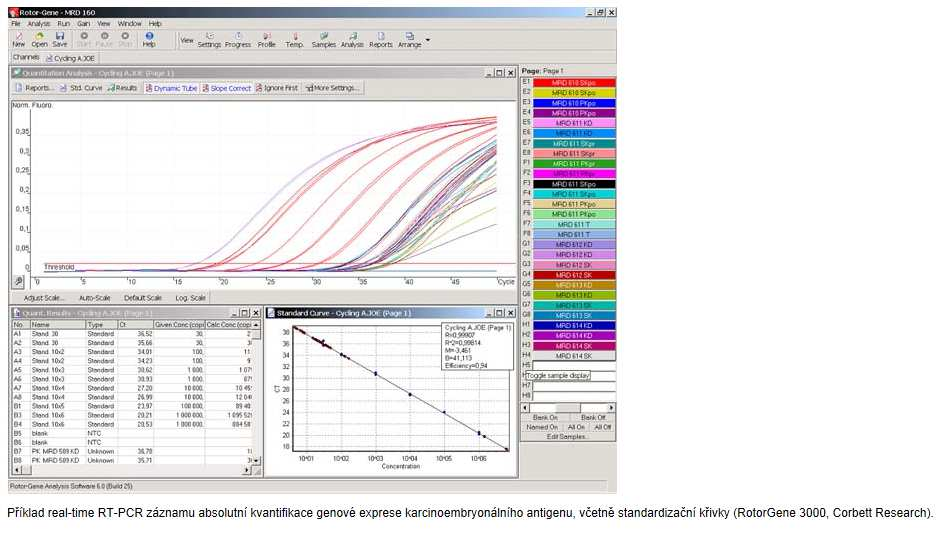 Real time PCR - počet cyklů nutných k náběhu exponenciální fáze -