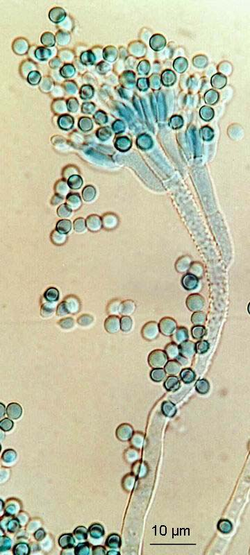 Penicillium commune mikroznaky, CCF