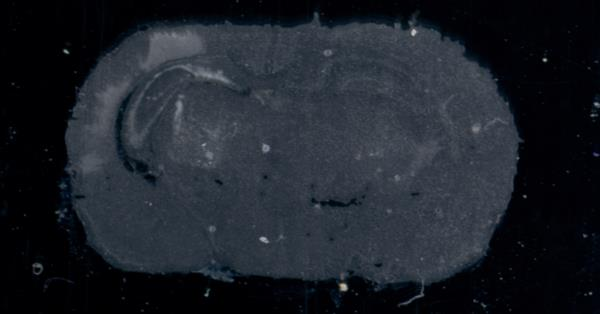 2. Mozková tkáň Hypoxicko-ischemicky poškozená neonatální myší mozková tkáň byla analyzována pomocí LA-ICP-MS s rozlišením 150 µm a rychlostí posunu laseru 150 µm/s.