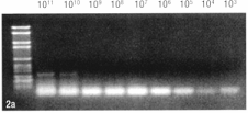 Princip polymerázovéřetězové reakce Pomocí PCR můžeme získat jak kopii genomové DNA, cdna (analyzovaný vzorek může být DNA i RNA).