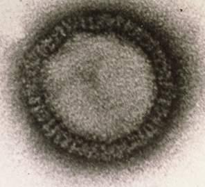 PB2 PB1 PA HA NP NA M NS Influenza (Orthomyxoviridae) virus chřipky minus ssrna, 8 segmentů, 8 genů, 10 proteinů HIV (Human Immunodeficiency