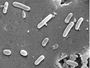 Největší prokaryotické genomy Pseudomonas aeruginosa (bakterie): - 5500 genů - přes 6 Mb - přirozeně rezistentní k antibiotikům (ochranný obal) - R-faktor, žije ve společenství jiných bakterií,