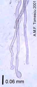 Rhizoidy hlevíků vznikají z povrchových buněk spodní strany stélky, jsou