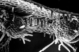 Rhizoidy vznikající na středním žebru laloků u frondózních a v blízkosti