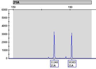 8. Výsledky a analýza Doporučené postupy pro diagnostiku aneuploidií pomocí QF-PCR byly stanoveny sdružením Clinical Molecular Genetics Society (UK) a Association for Clinical Cytogenetics (UK) a