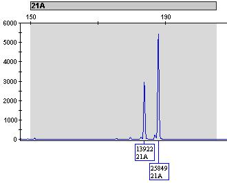 Obr. 8.2. Trizomický marker (poměr ploch 1:1:1) Obr. 8.3.