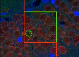 Fluorescenční mikroskopie Kvantifikace počet buněk na ploše (zorné pole/počítací Gundersonovo